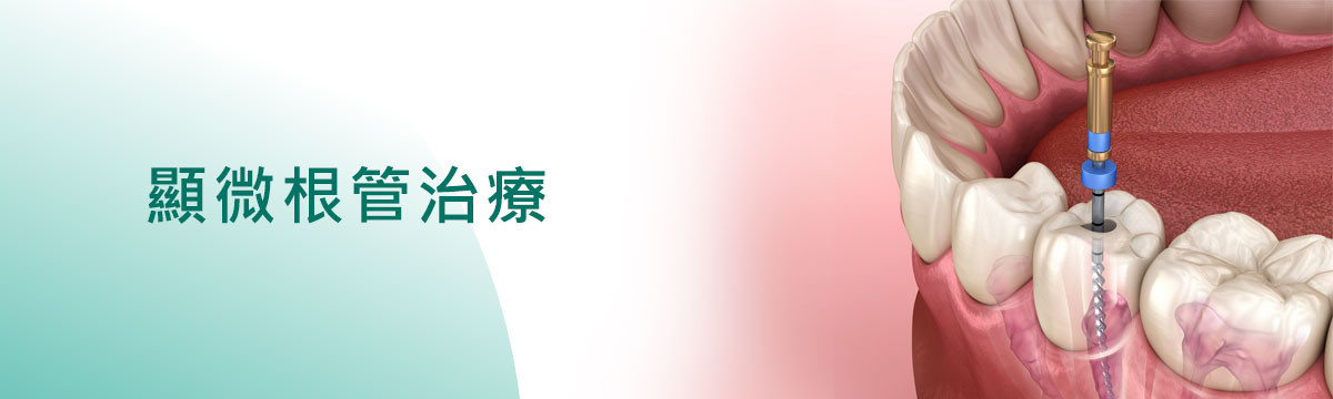 顯微根管治療 桃園顯微根管治療